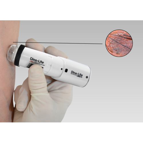 DermaScope-500x500