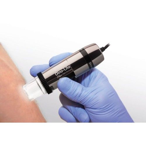 Dino-Lite-DermaScope-MEDL7DW-2-500x500
