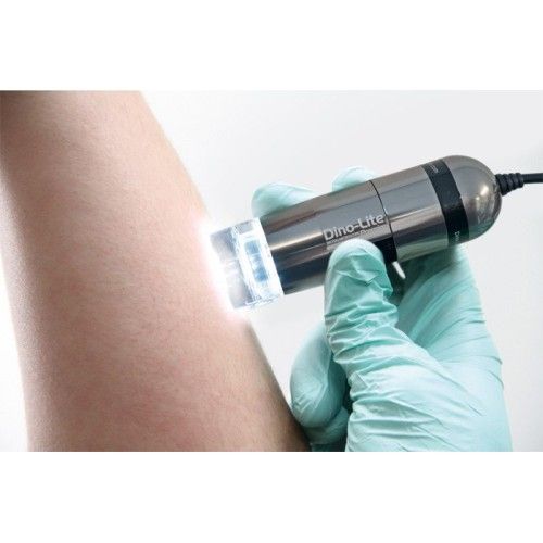 dermascope-medl7dm-main-500x500